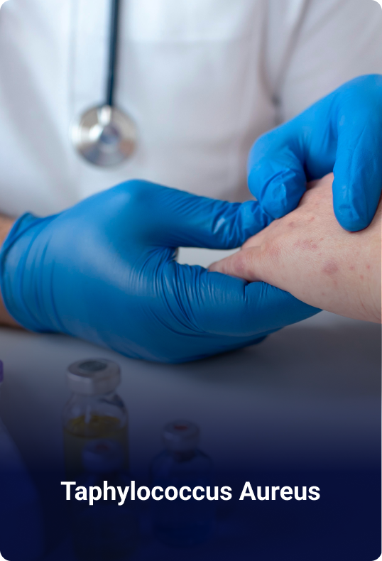Contoh pengujian mikrobiologi: Staphylococcus aureus